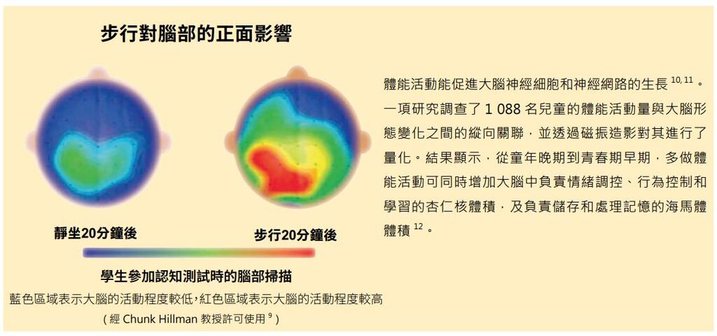 brain scan