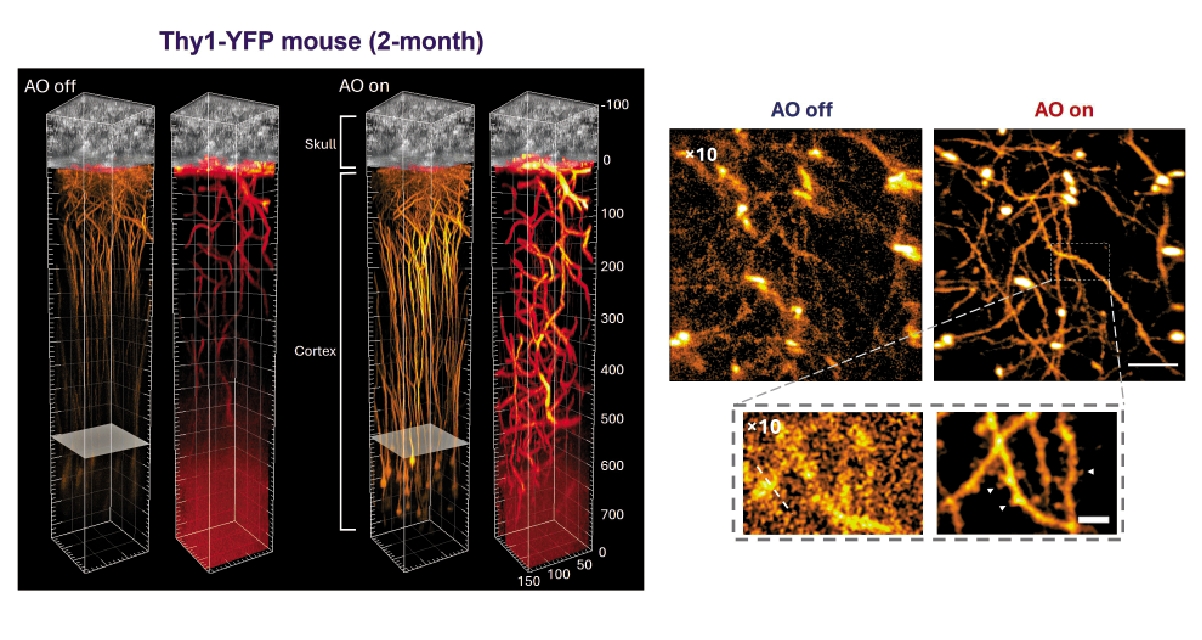　　图：图中两组示例的右方，为小鼠大脑神经网络的高清晰成像。