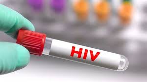 國際最新研究：單一突變基因幹細胞移植或實現艾滋病持續緩解