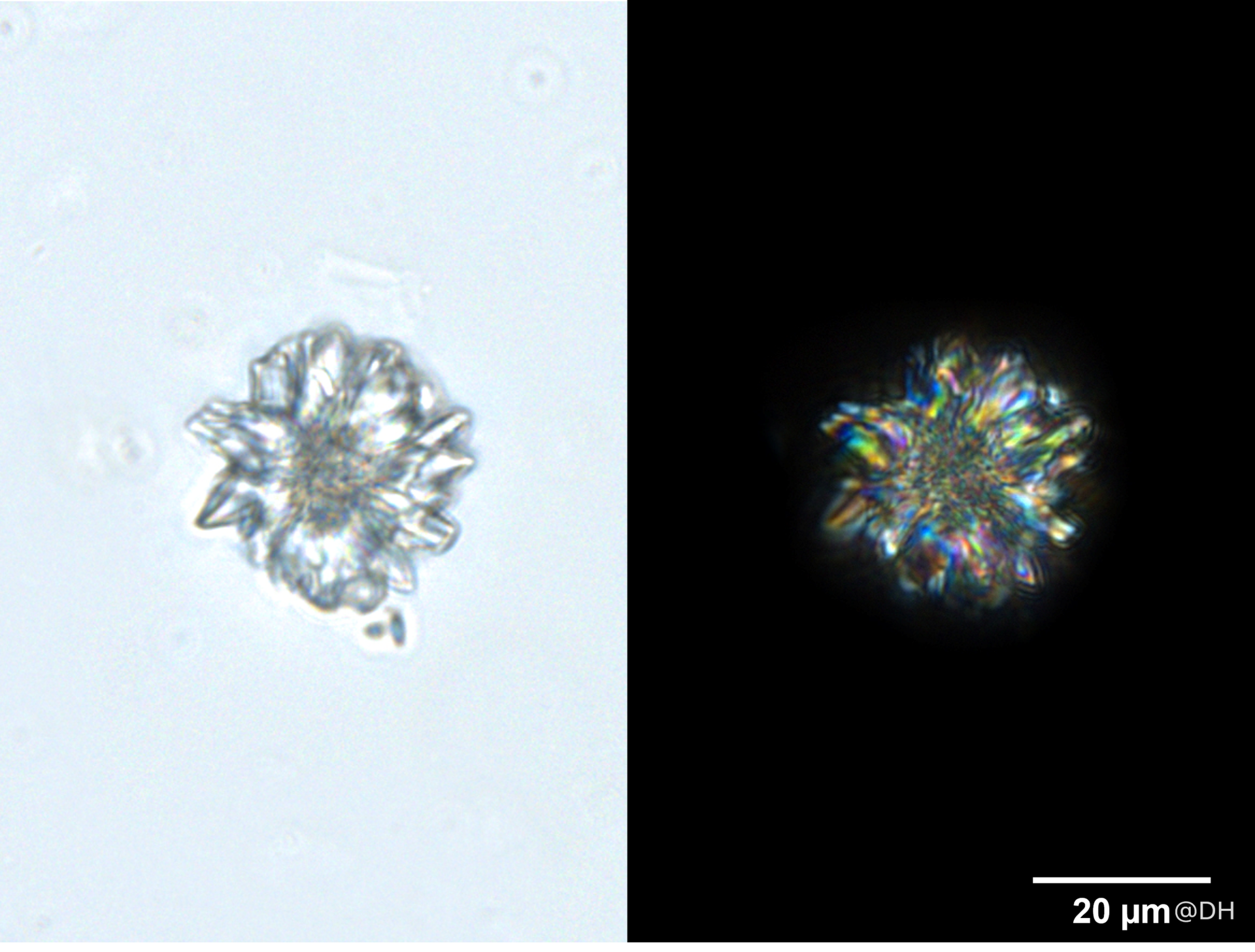圖片1_五加皮的草酸鈣簇晶 (DH)