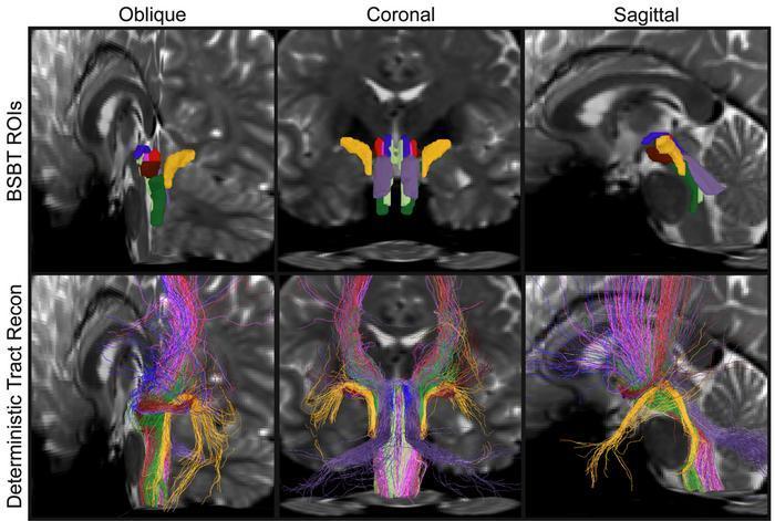 AI算法自動解析腦幹白質神經束