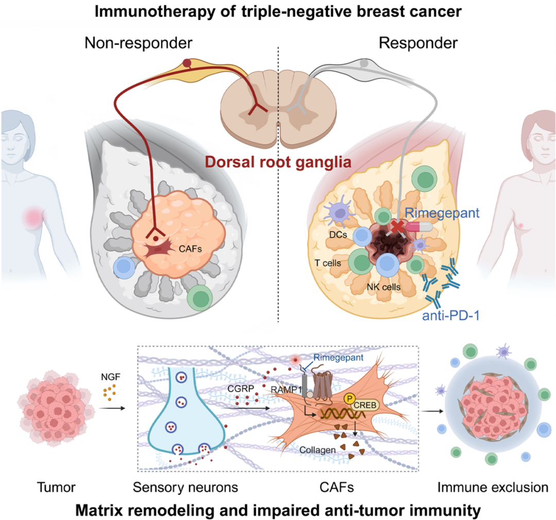 复旦最新Cell：偏头痛药物或能“助攻”抗癌！—新闻—科学网